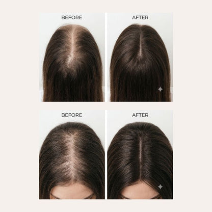 AURELLE™ — The Reignition Comb